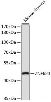 Immunohistochemistry of paraffin-embedded Rat heart using KATNA1 Polyclonal Antibody at dilution of 1:100 (40x lens).