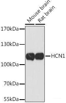 Immunofluorescence analysis of HeLa cells using BAZ1A Polyclonal Antibody at dilution of 1:100 (40x lens). Blue: DAPI for nuclear staining.