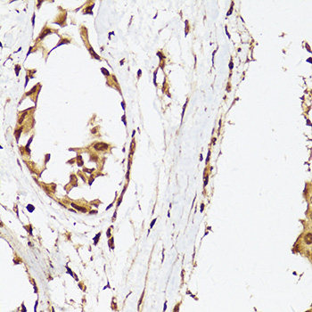 Western blot analysis of extracts of Rat brain using HRH3 Polyclonal Antibody at dilution of 1:1000.
