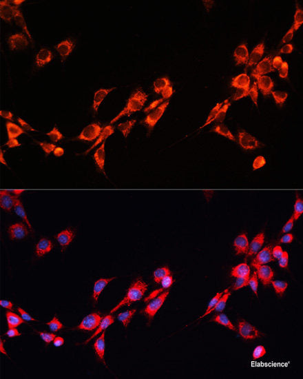 Immunofluorescence analysis of L929 cells using CTNNA3 Polyclonal Antibody at dilution of 1:100. Blue: DAPI for nuclear staining.