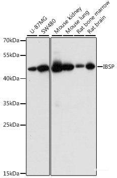 Western blot analysis of extracts of various cell lines using CD46 Polyclonal Antibody at dilution of 1:1000.