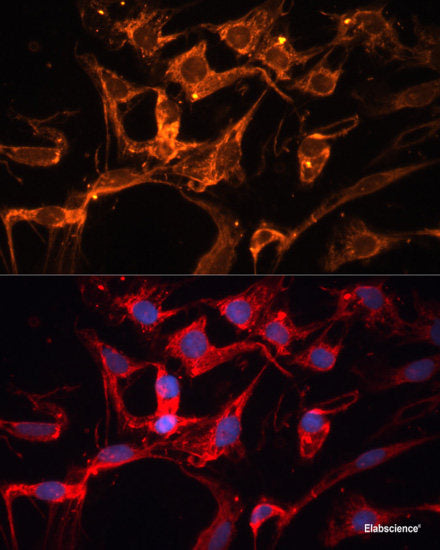 Western blot analysis of extracts of HeLa cells using OGFOD1 Polyclonal Antibody at dilution of 1:1000.