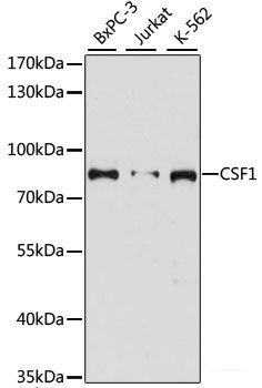 Immunofluorescence analysis of L929 cells using SEPT3 Polyclonal Antibody at dilution of 1:100. Blue: DAPI for nuclear staining.