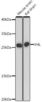 Immunofluorescence analysis of HeLa cells using Beta-TRCP Polyclonal Antibody