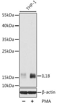 Western blot analysis of extracts of various cell lines using ZNF471 Polyclonal Antibody at dilution of 1:1000.