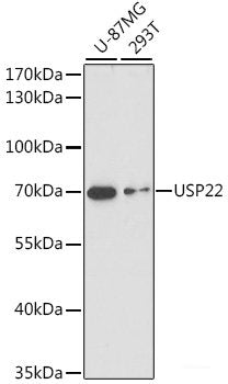 Immunofluorescence analysis of Rat brain using KIF17 Polyclonal Antibody at dilution of 1:100. Blue: DAPI for nuclear staining.