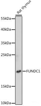 Immunohistochemistry of paraffin-embedded Human liver cancer using SLAMF7 Polyclonal Antibody at dilution of 1:100 (40x lens).
