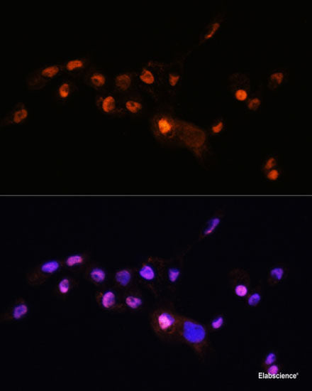 Immunofluorescence analysis of C6 cells using ACBD3 Polyclonal Antibody at dilution of 1:100. Blue: DAPI for nuclear staining.