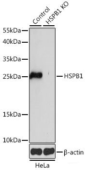 Western blot analysis of extracts of various cell lines using HKDC1 Polyclonal Antibody at dilution of 1:1000.