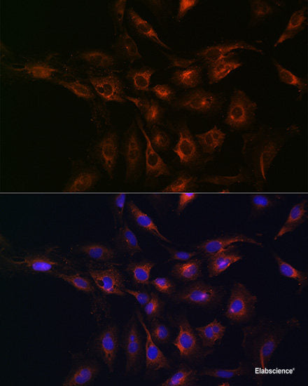 Western blot analysis of extracts of Rat spleen using YPEL3 Polyclonal Antibody at dilution of 1:1000.