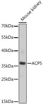 Immunofluorescence analysis of HeLa cells using CA9 Polyclonal Antibody at dilution of 1:100. Blue: DAPI for nuclear staining.
