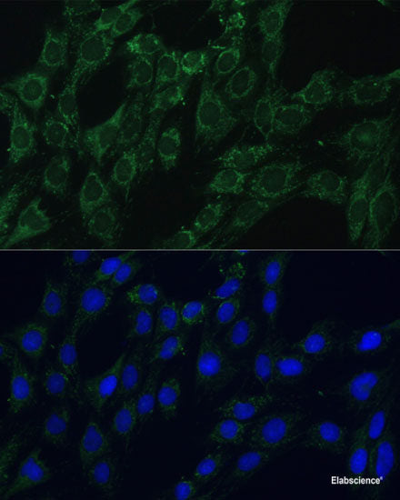 Immunohistochemistry of paraffin-embedded Human placenta using DTNBP1 Polyclonal Antibody at dilution of 1:100 (40x lens).