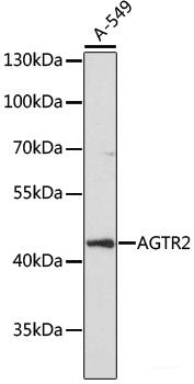 Western blot analysis of extracts of Rat lung using ZGPAT Polyclonal Antibody at dilution of 1:1000.