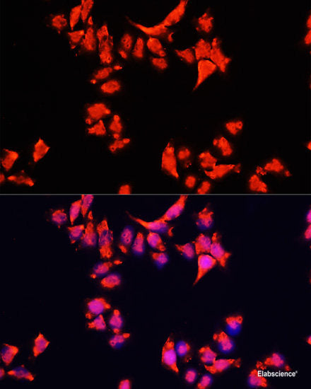 Immunofluorescence analysis of L929 cells using ARHGAP11B Polyclonal Antibody at dilution of 1:100. Blue: DAPI for nuclear staining.