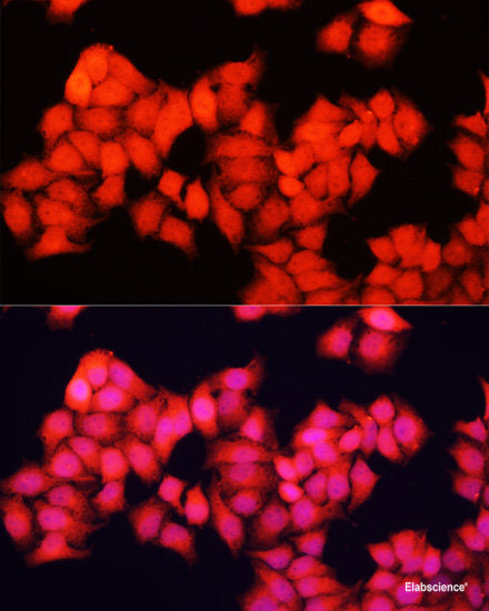 Western blot analysis of extracts of Mouse eye using DHX57 Polyclonal Antibody at dilution of 1:1000.