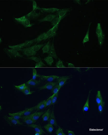 Western blot analysis of extracts of Rat testis using DNAAF1 Polyclonal Antibody at dilution of 1:1000.
