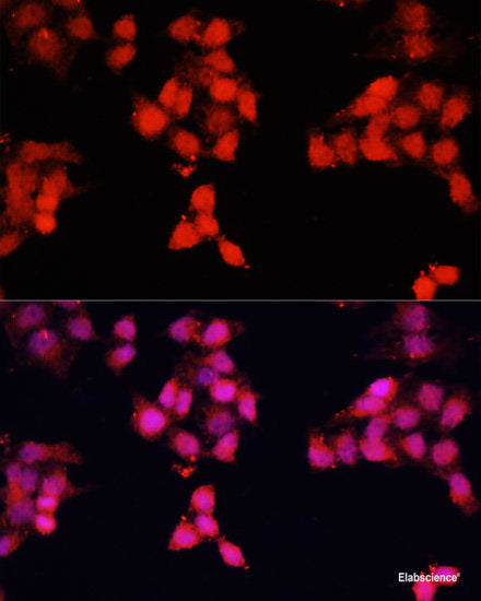 Immunofluorescence analysis of HeLa cells using HRNR Polyclonal Antibody at dilution of 1:100 (40x lens). Blue: DAPI for nuclear staining.