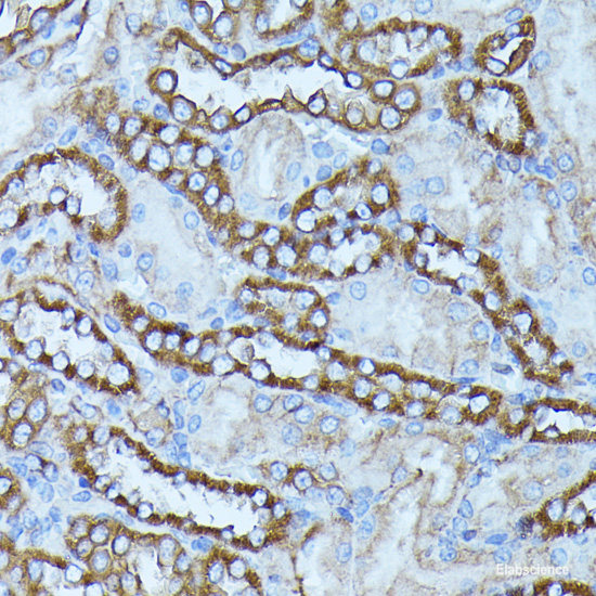 Western blot analysis of extracts of various cell lines using Cpsf4l Polyclonal Antibody at dilution of 1:1000.