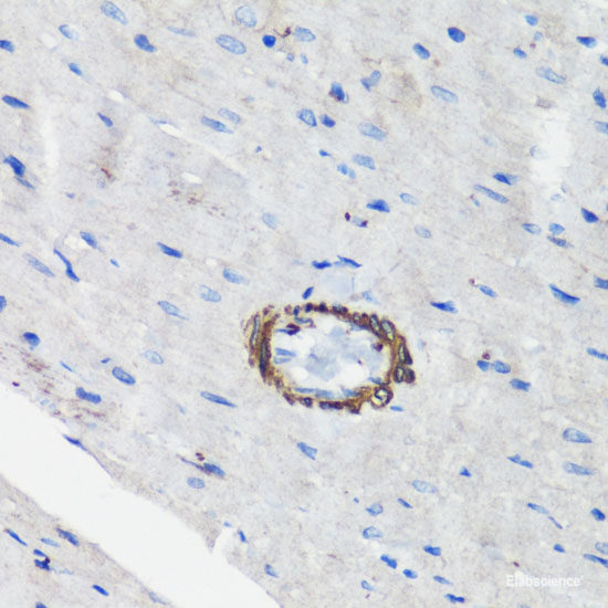 Immunohistochemistry of paraffin-embedded Human placenta using TXNRD1 Polyclonal Antibody at dilution of 1:100 (40x lens).