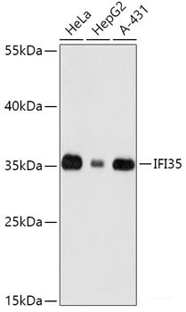 Immunohistochemistry of paraffin-embedded Human colon using TGFB1 Polyclonal Antibody at dilution of 1:100 (40x lens).