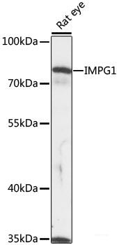 Immunohistochemistry of paraffin-embedded Rat brain using PDPK1 Polyclonal Antibody at dilution of 1:200 (40x lens).