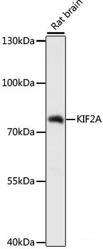 Immunohistochemistry of paraffin-embedded Rat kidney using UGT2B15 Polyclonal Antibody at dilution of 1:100 (40x lens).