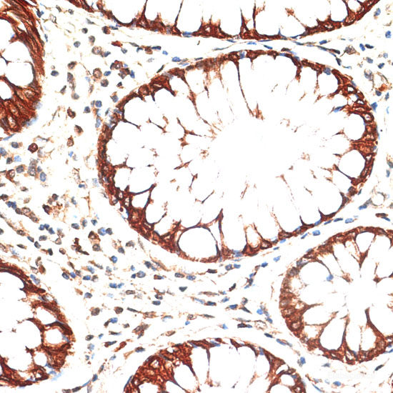 Immunofluorescence analysis of L929 cells using DRP1 Polyclonal Antibody at dilution of 1:100 (40x lens). Blue: DAPI for nuclear staining.