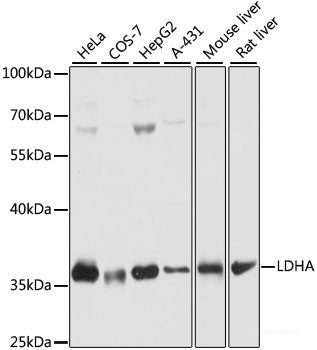 Western blot analysis of extracts of Mouse lung using SCN5A Polyclonal Antibody at dilution of 1:1000.