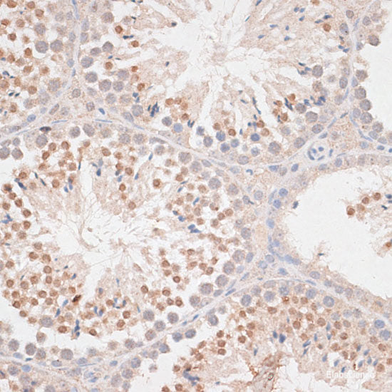 Immunohistochemistry of paraffin-embedded Rat brain using ATXN2 Polyclonal Antibody at dilution of 1:100 (40x lens).