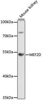 Immunofluorescence analysis of C6 cells using ESR1 Polyclonal Antibody at dilution of 1:100. Blue: DAPI for nuclear staining.