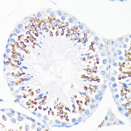 Immunohistochemistry of paraffin-embedded Human placenta using ASC / TMS1 Polyclonal Antibody at dilution of 1:100 (40x lens).