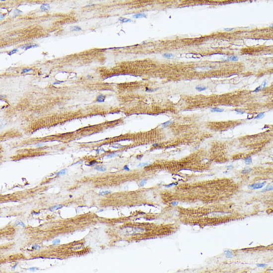 Immunohistochemistry of paraffin-embedded Rat lung using Decorin Polyclonal Antibody at dilution of 1:200 (40x lens).
