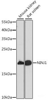 Immunofluorescence analysis of Rat spleen using CD70 Polyclonal Antibody at dilution of 1:100 (40x lens). Blue: DAPI for nuclear staining.