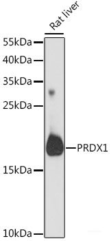 Western blot analysis of extracts of SGC-7901 cells using CCL4 Polyclonal Antibody.