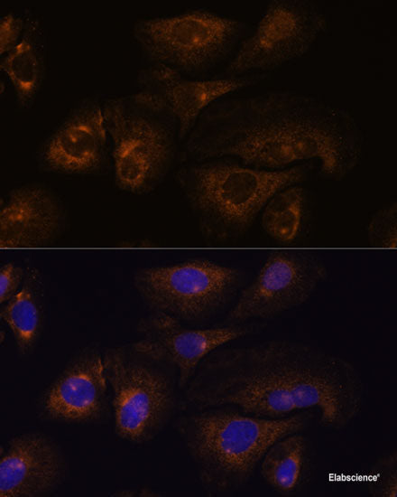 Immunofluorescence analysis of NIH/3T3 cells using PLA2G5 Polyclonal Antibody at dilution of 1:100. Blue: DAPI for nuclear staining.