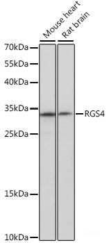 Immunohistochemistry of paraffin-embedded Human colon using p27 KIP 1 Polyclonal Antibody at dilution of 1:200 (40x lens).