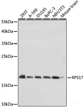 Immunofluorescence analysis of Rat heart using TTN Polyclonal Antibody at dilution of 1:100. Blue: DAPI for nuclear staining.