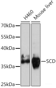 Immunofluorescence analysis of U-251 MG cells using ABCA2 Polyclonal Antibody at dilution of 1:100 (40x lens). Blue: DAPI for nuclear staining.