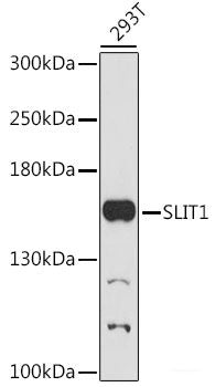 Immunofluorescence analysis of C6 cells using IL18 Polyclonal Antibody at dilution of 1:100. Blue: DAPI for nuclear staining.