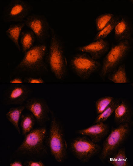 Immunohistochemistry of paraffin-embedded Human colon carcinoma using SNIP1 Polyclonal Antibody at dilution of 1:100 (40x lens).