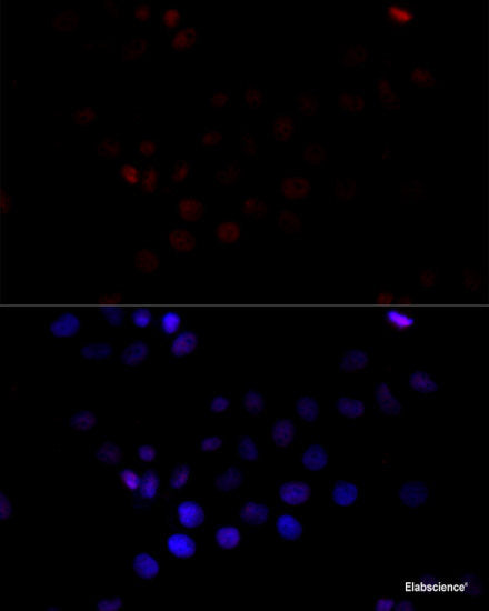 Western blot analysis of extracts of various cell lines using ADARB1 Polyclonal Antibody at dilution of 1:1000.
