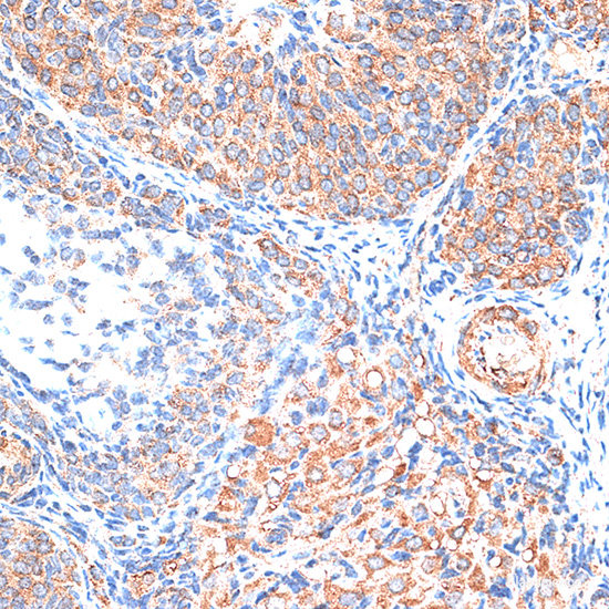 Immunofluorescence analysis of MCF-7 cells using PAX3 Polyclonal Antibody