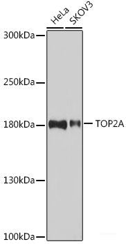Immunohistochemistry of paraffin-embedded Human liver using APOD Polyclonal Antibody at dilution of 1:100 (40x lens).