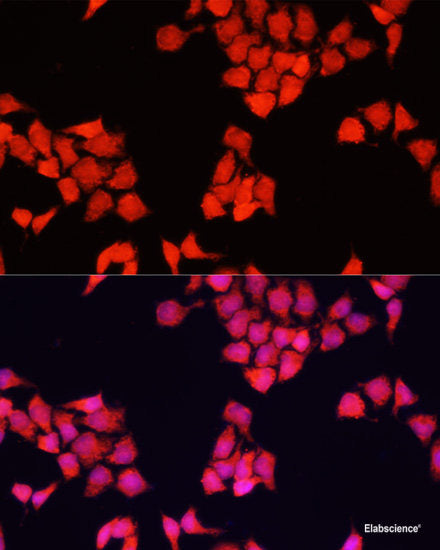 Western blot analysis of extracts of Mouse brain using RHOB Polyclonal Antibody at dilution of 1:1000.