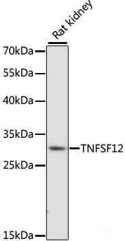 Immunohistochemistry of paraffin-embedded Human appendix using XRCC4 Polyclonal Antibody at dilution of 1:100 (40x lens).
