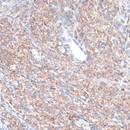 Immunofluorescence analysis of U2OS cells using KAT5 Polyclonal Antibody at dilution of 1:100. Blue: DAPI for nuclear staining.