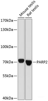 Immunohistochemistry of paraffin-embedded Human lung cancer using CAST Polyclonal Antibody at dilution of 1:100 (40x lens).