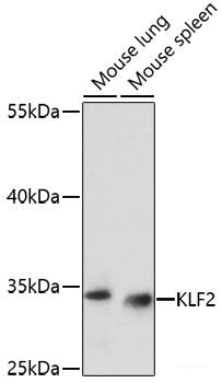 Immunohistochemistry of paraffin-embedded Human tonsil using CASQ1 Polyclonal Antibody at dilution of 1:100 (40x lens).