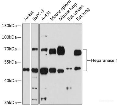 Immunohistochemistry of paraffin-embedded Mouse heart using CASQ2 Polyclonal Antibody at dilution of 1:100 (40x lens).
