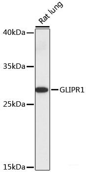 Western blot analysis of extracts of various cell lines using CCKAR Polyclonal Antibody at dilution of 1:1000.